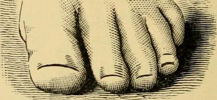 Foot Shape Ancestry: What Your Toes Can Tell You bit.ly/2Dq9u38 #genealogy #familyhistory #ancestry https://t.co/Q7MsIfqUnm