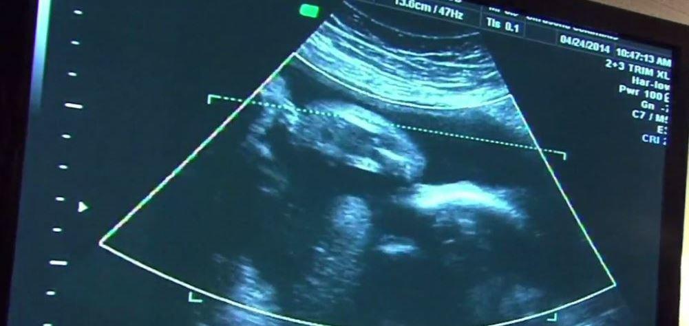 10TV's tweet photo. #BREAKING: Ohio House passes 'heartbeat' abortion bill which would ban abortions in Ohio after the first fetal heartbeat is detected, as early as six weeks into a pregnancy https://t.co/xHY783Gnlb #10TV https://t.co/famyWQXzdW