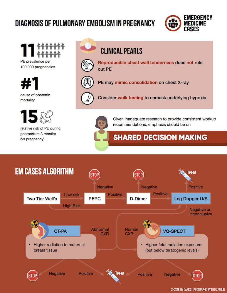 EMCases's tweet photo. Suspected PE in Pregnancy infographic by Pouria Rezapour

Based on EM Cases main episode with @EddyLang1 @kerstinhogg &amp; Best Case Ever with @ETtube

https://t.co/PuU7CRsRq7
#FOAMed https://t.co/keuY7WWzft