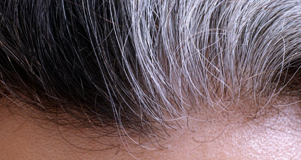 WebMD's tweet image. It's not just growing older that can make your hair go gray: Lack of vitamin B12, vitiligo, and certain thyroid conditions can do it too. wb.md/2FmIZOA