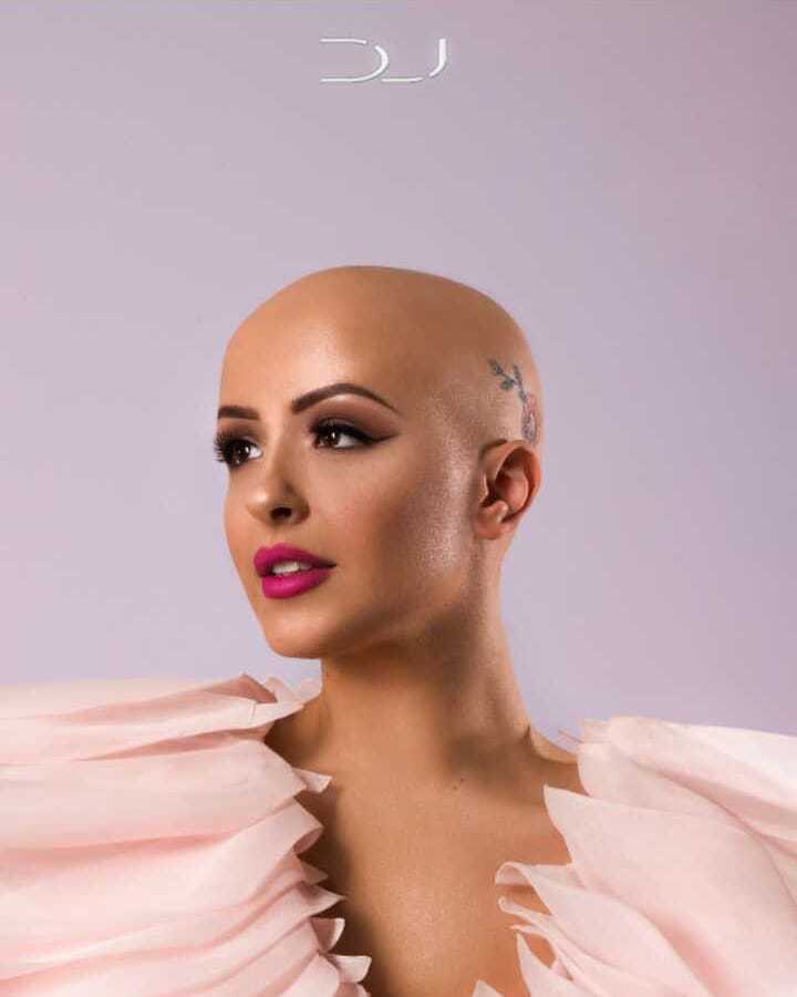 Alopecia is Fashion Campaign
alopeciaworld.com/profiles/blogs…