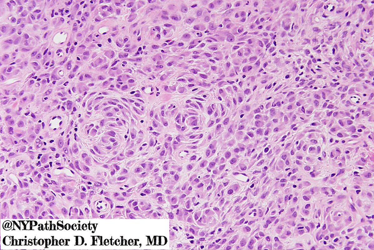 Unknowns with Dr Christopher Fletcher. Elderly female with a firm ...