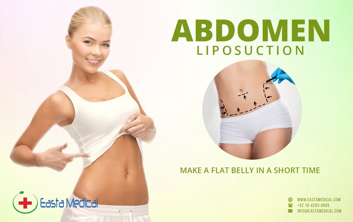 Get a flat belly without excercise!
More: bit.ly/2JGsSMx
#wherecanyougetliposuction
#liposuctiontoremovefacefat
#abdominaltummytuck
#abdominalliposuctionprice
#upperabdominalliposuctionbeforeafter
#beautybay #girlwhostruggles 
#weightlosstransformation 
#WeightLoss