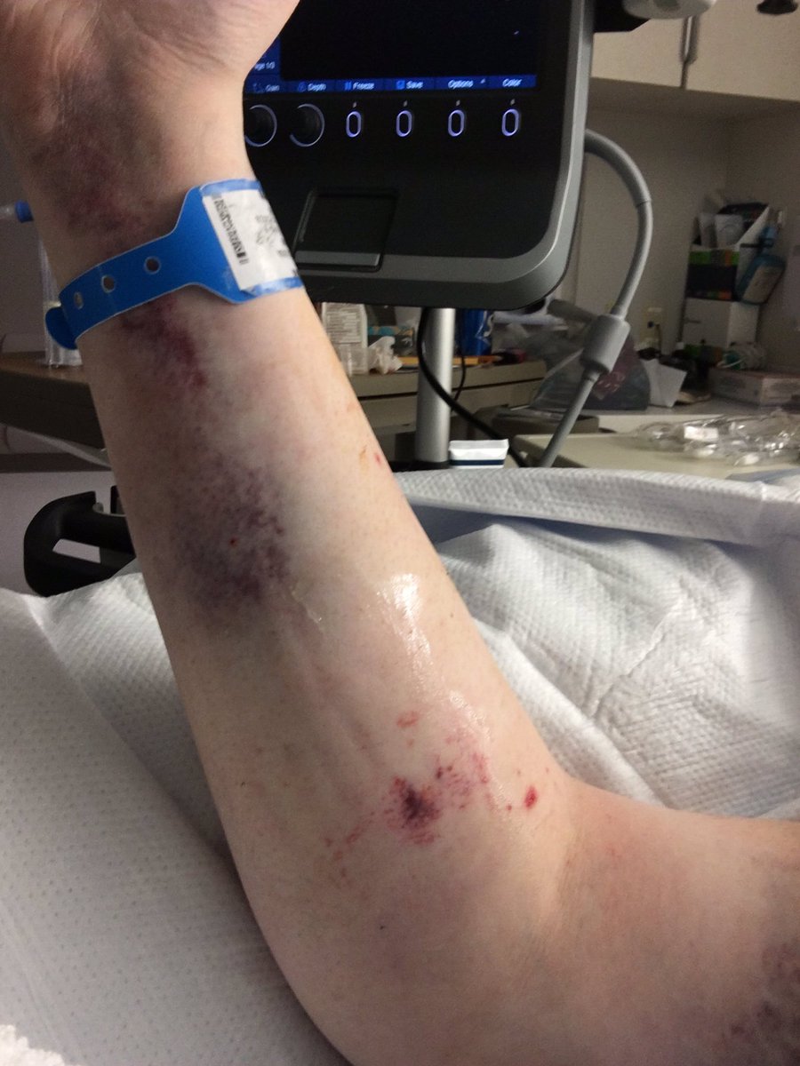 Having a great time lol