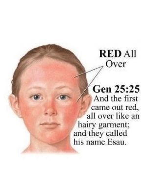 yahuahisyahuah's tweet photo. @Uziah_ @King_inBlck Are you convinced that Esau is the Caucasian Red Man now?
#Esau #edom #caucasian #MtSeir #CaucasusMountains #Petra #WhitePeople #Edomites #romans #idumeans #identityexposed #whitewash #Renaissance https://t.co/PfamMiTdTI