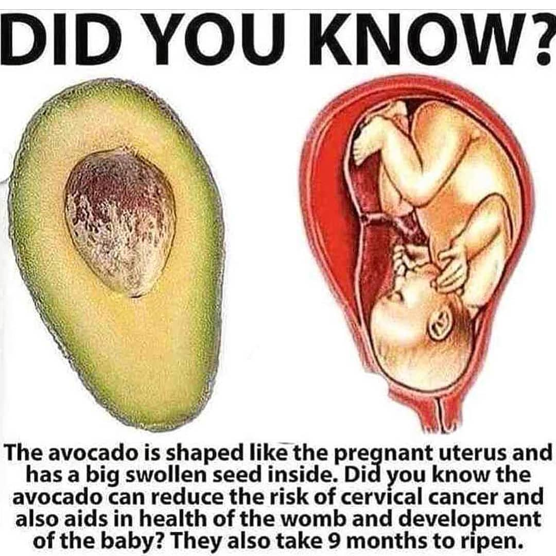 HealthKaDose's tweet photo. Avocado is Life!
.
.
.
#holistichealer #newage #thirdeye #growplants #plantfood #veganism #diet #organicfood #happiness #healthtips #healer #holistic #plantmedicine #cbd #natural #motivation #motherhood #pregnancy #newwlife #childbirth #benefitsofavocado #avocado https://t.co/HkH4pc96gS