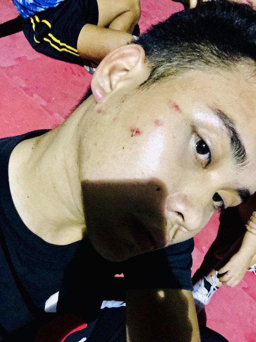mikee_vasquezzz's tweet photo. Wait what? Again? Tsktsk!
Cheer thing be like. πͺπ»
Laban pa rin! β€οΈ #AceAllStars ππ» https://t.co/wXZLN0SY2e