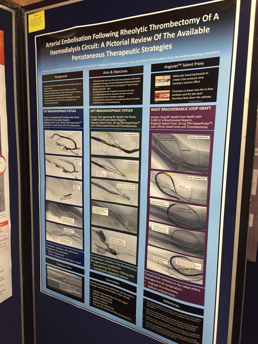 ADiamantop's tweet photo. Congratulations to Dr Ben Corbo for winning this year's BSIR award for best educational poster. #BSIR2018 @BSIR_News @GSTTnhs @narayan_karu #withoutascalpal @cirsesociety https://t.co/2eL61hLSm7
