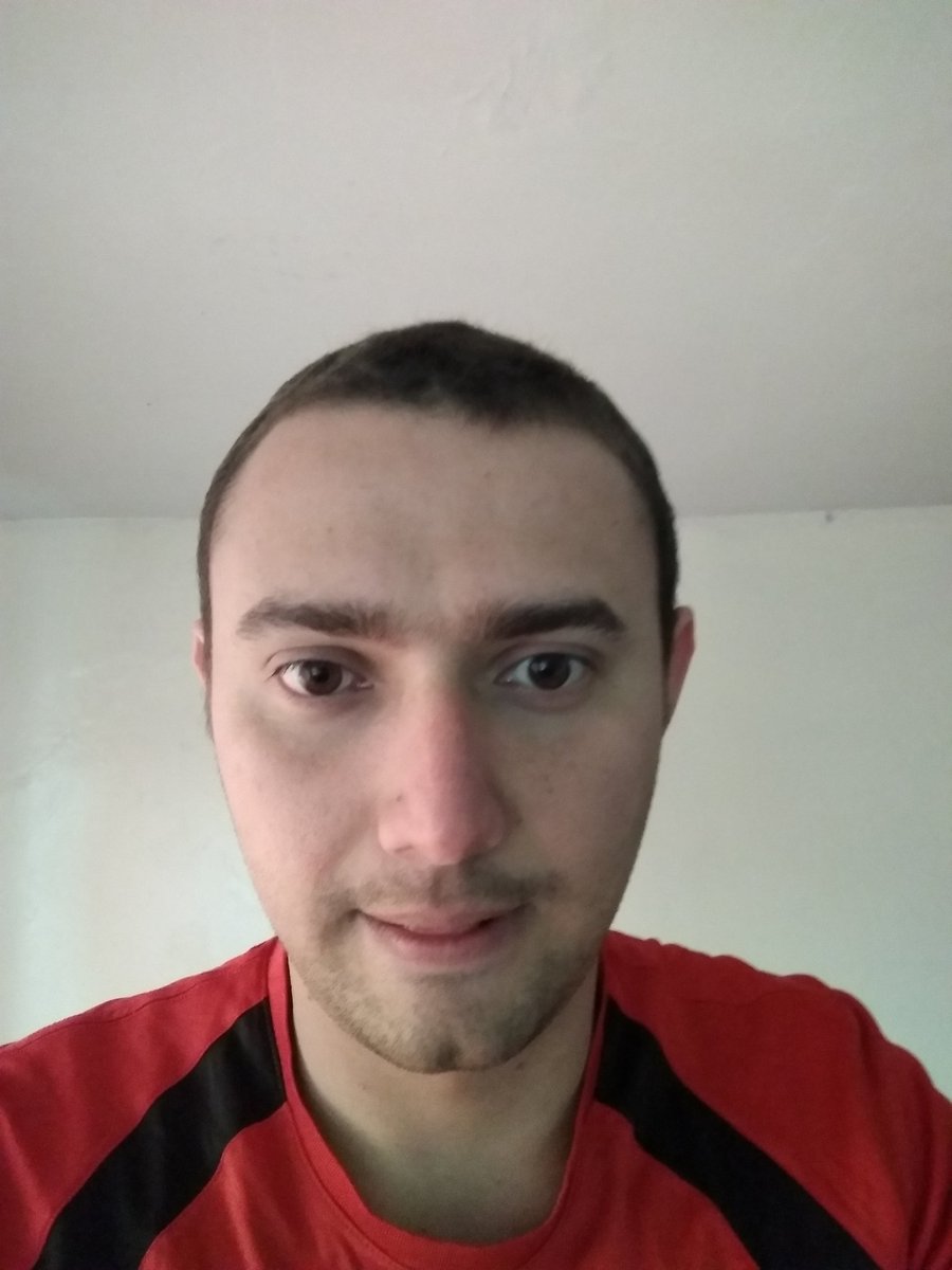 fabres21s's tweet photo. Hace un año recibía la primera quimioterapia, tenía miedo, pero con la esperanza que todo estaría bien, y parece ser que sí, que esta vez, yo gané, le gané al cáncer. 😁🤗🤗🤗 https://t.co/pllQLx43wC