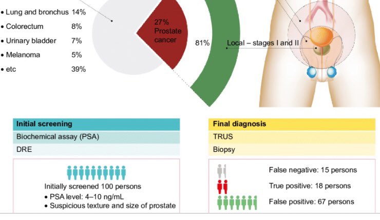 CancerLarge's tweet image. Just got my cancer diagnosis, gotta get my left nut removed