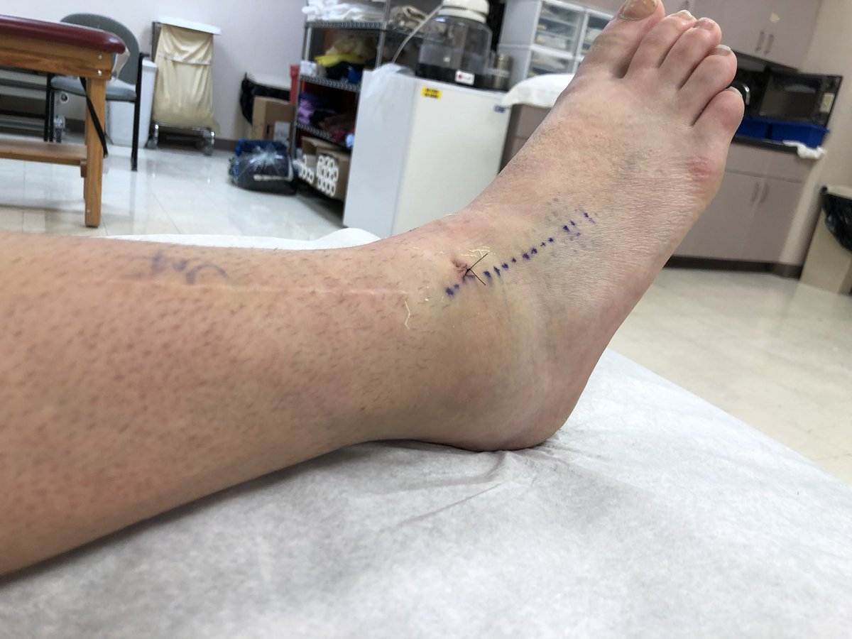 KPotter24's tweet photo. sometimes you really gotta look at the progress you’ve made and not how far away you are from the goal https://t.co/sT3OTOsYht