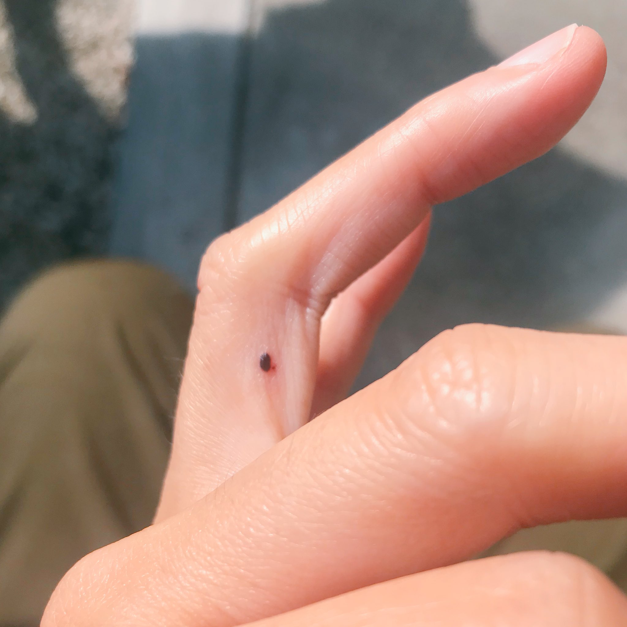 Cozo Chan O No Twitter はっ マダニ えっ チマメ 血豆 いつの間に 月下虫音 マダニ 血豆 どっちも気をつけよう T Co Swc94fzbws Twitter