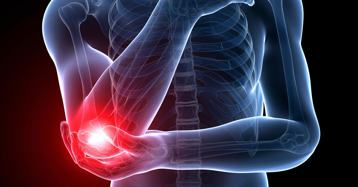 AHealthBlog's tweet photo. Exercise a More Effective Treatment for Tennis Elbow ➡ https://t.co/AQZB81YGmP https://t.co/Rkm69dRSFN