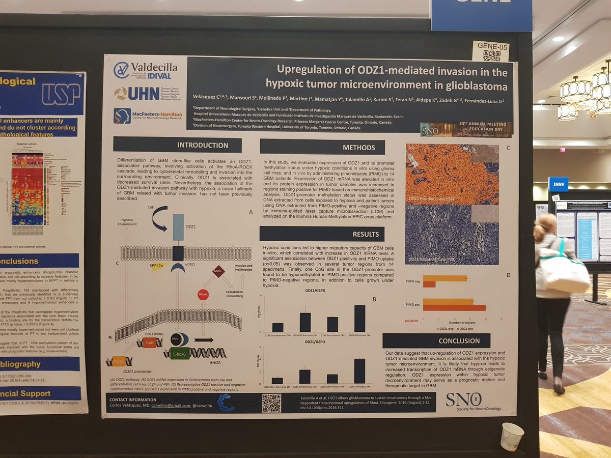 carvelhn's tweet photo. Happy to share some results about the #ODZ1 -mediated invasion in #Glioblastoma #hypoxic #tumormicroenviroment at @NeuroOnc! A collaborative project between @ZadehLab & @IDIVALdecilla @NeuroRaquisHUMV #SNO2018 @Pms86 @MansouriSheila https://t.co/DXFbN6ad4o https://t.co/IpOR2ppxBi