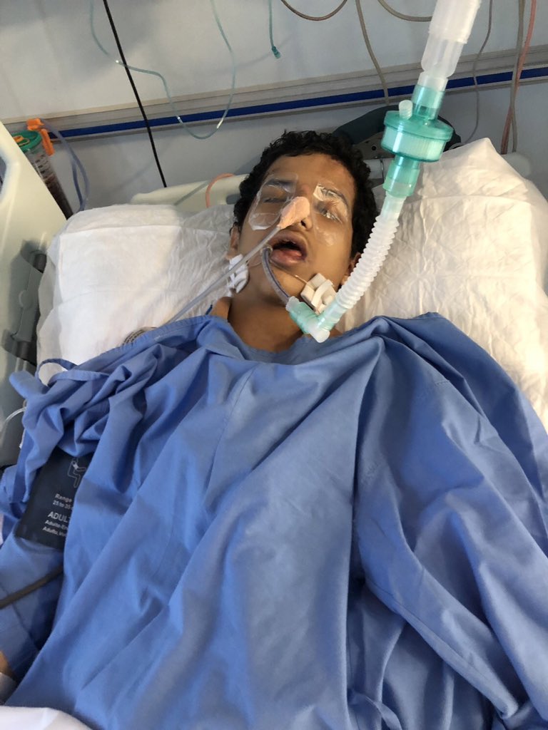 s7785's tweet image. الوطن يناشد المسؤولية قد تعرض إبني لعملية دهس وهو موجود بأحد مستشفيات الرياض الخاصة وإمكانياتهم ضعيفة جدا وحالته كل يوم تسوء ارجوا نقله لأحدى المستشفيات الحكومية كمدينة الملك فهد تكفى يابوفهد إعتبره أحد أبناءك وهو كذلك
0553759598
#حايل_الان
#وش_اخر_صوره_صورتها

#الشوق