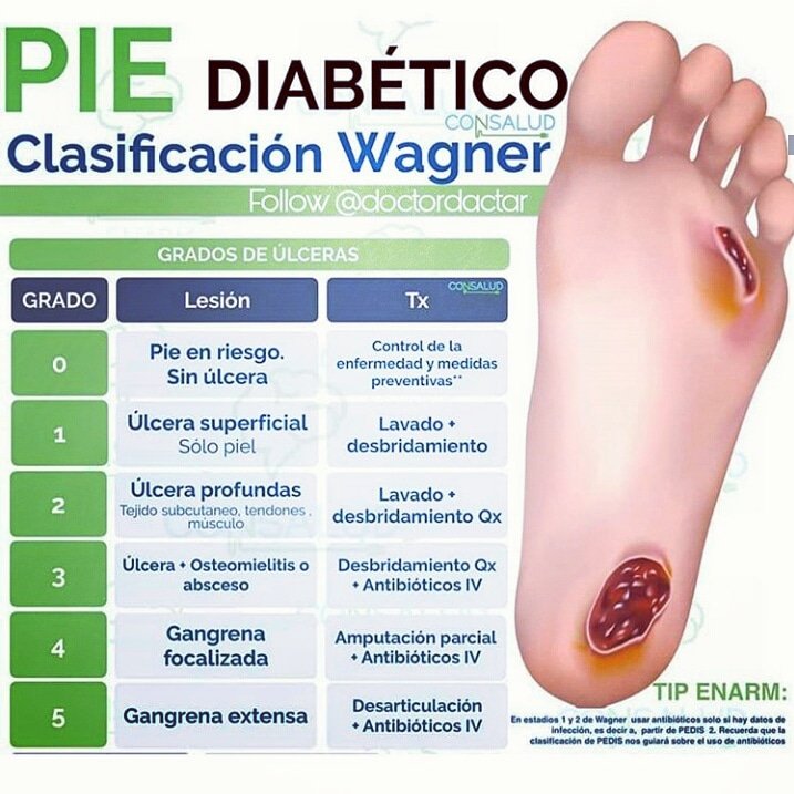 Hospitadravm on Twitter "Diagnóstico del Pie Diabético. Aprendiendo medicina Prevención 