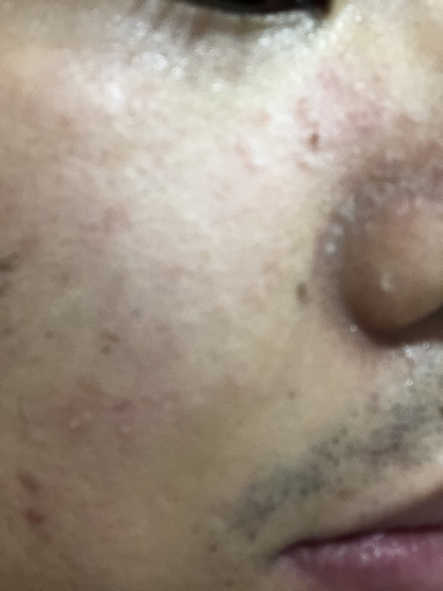 もこう 在 Twitter 上 3日風呂に入らなかった男の末路 T Co Xwnqxq01yz Twitter