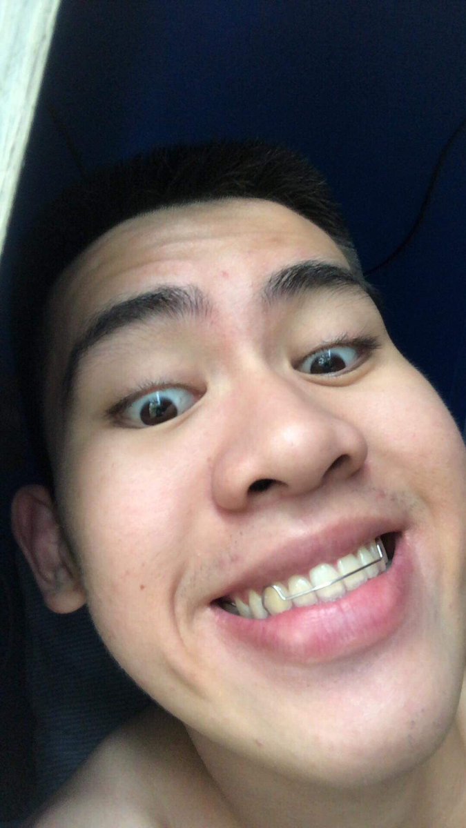Recyclevin_'s tweet photo. RT for Clear skin or else balakayojan. ✨ https://t.co/IawSOBfZPt