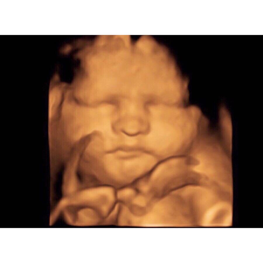 Chasityshea12's tweet photo. @SavannahSoutas I am a single mom expecting my daughter, Lilah on 1/12! She is my first child and I absolutely cannot wait for her to be here! I’d love to be considered for the giveaway! It would help out so much in making sure I have everything I need for her! https://t.co/hi8nhQQGws