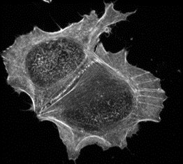 The Dawson Lab (@cellbiophysics) on Twitter photo Images of actin cytoskeleton highlight the critical role of structural proteins in dictating cell shape <a href="/DawsonStemCell/">Michelle R Dawson</a> #biomechanics #cytoskeleton Images of actin cytoskeleton highlight the critical role of structural proteins in dictating cell shape <a href="/DawsonStemCell/">Michelle R Dawson</a> #biomechanics #cytoskeleton