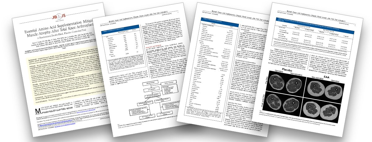 jbjs's tweet image. Highlights from #JBJS - Essential Amino Acid Supplementation Mitigates Muscle Atrophy After Total Knee Arthroplasty hubs.ly/H0fzbwQ0 #JBJSOpenAccess
