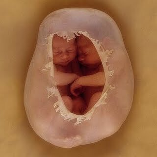 Sean uno o dos bebés, desde el momento de la concepción están íntimamente ligados a sus padres y son perfectamente independientes. 
EL MILAGRO DE LA VIDA. 
#SiALaVida
