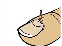 NailsforNewbies's tweet photo. Oh those pesky #hangnails, here are 5 ways to prevent getting these:
1. Keep your nail beds moisturized
2. Remove hangnails while they're short
3. Avoid biting or picking at your nails
4. Trim your nails frequently
5. Maintain a healthy, balanced diet https://t.co/dueNQgtaFa