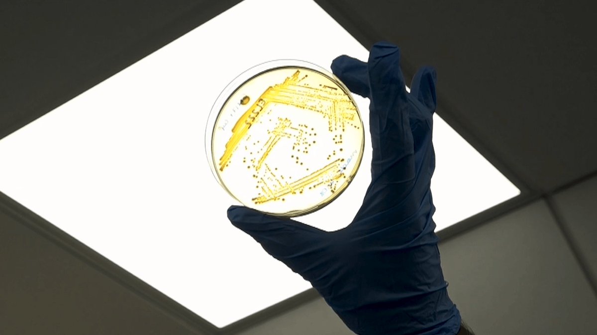 AdvPortfolio's tweet image. Transforming human stem cells into bone with the help of non-pathogenic bacteria  @UofGlasgow #stemcells #RegenMed #healthcare #materials #bones - Watch how it's done: ow.ly/Iedl30mFj3S