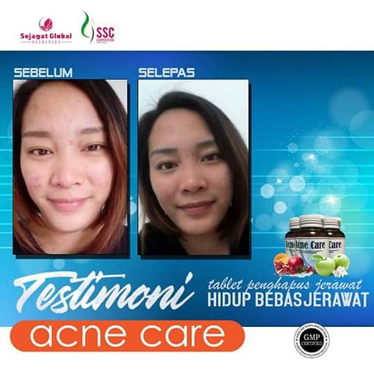 anne_puan's tweet photo. Sebelum dan selepas 😊 https://t.co/oKZIMLhwBm