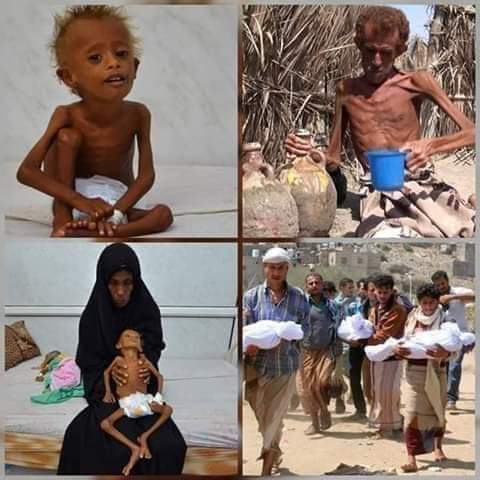 kamila_baalbake's tweet photo. صبرا صبرا ولكم في الآخرة اجرا عظيم وللظالمين   في انتظارهم جهنم وبئس المصير #دعمًا_لأطفال_اليمن https://t.co/BVXF3SYcfj
