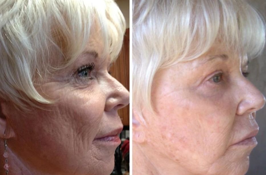 Using Face Yoga Treatments To Reclaim Your Youth goo.gl/lWDvf