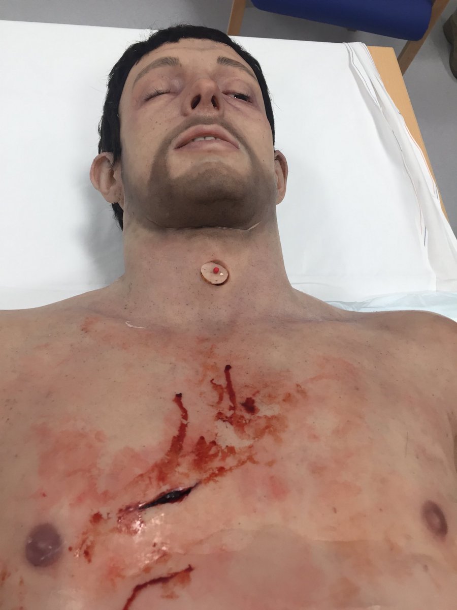 EshtResus's tweet photo. ⁦@danielle_vidler⁩ ⁦@markedwards999⁩ ⁦@drswalton⁩ ⁦@Prometheusmed⁩ ⁦@ESHT_ESME⁩ superb realism on this mannikin best thing ive ever seen! #traumaticarrest hopefully coming to ESHT soon ⁦@Friends_DGH⁩ #simtraining https://t.co/J3zhlbUmUq