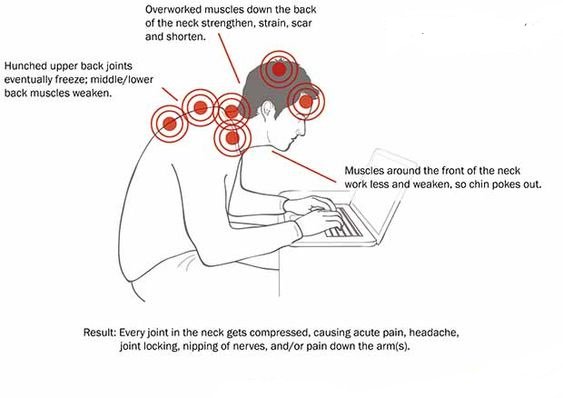 Heike Watson Physio There S No Question That Hunching Over Screens All Day Is Doing Some Damage To Our Spines And Posture Hunching Can Cause Severe Back Pain Neck Pain And