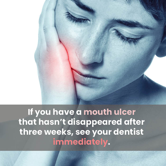 Mouth ulcers that don't go away, or keep coming back, can be an early sign of oral cancer, so don't ignore them! At Tickhill Dental and Implant Centre, we routinely screen for oral cancer during your check-up, too. #mouthcanceraction