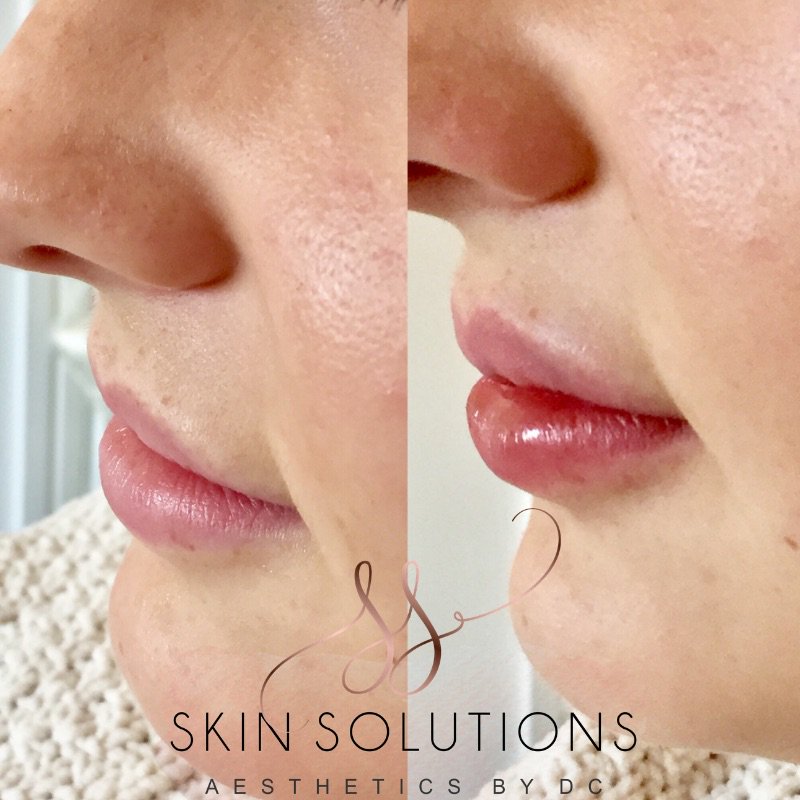 SkinSolutions5's tweet photo. Students can get 10% off most Aesthetic and beauty treatments with a valid student card! 🙌🏻 #studentlife #uclan #preston @UCLan https://t.co/1xNSup1QMQ