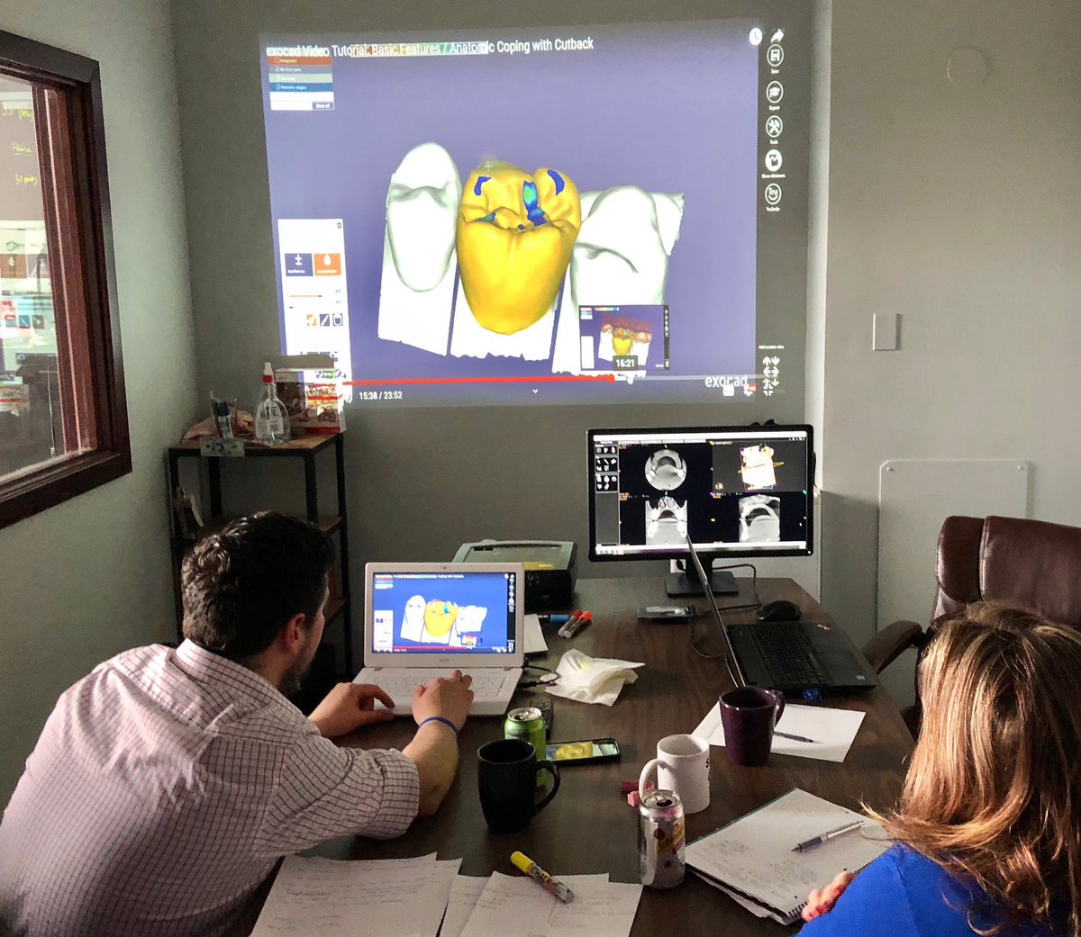 #DigitalDentistry #CBCT #3Dscanning #3Dprinting #CADCAM #DigitalDental #Dentist #WorkFlow #BreakBRED 😷🦷💜😁📈