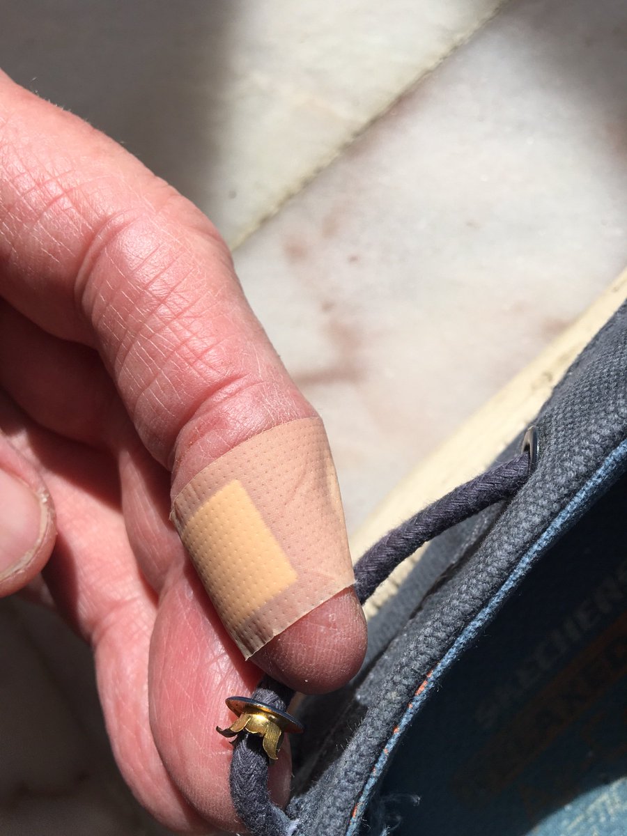 SophieLeeming1's tweet photo. @SKECHERS_UK sliced open a couple of fingers this morning with this super sharp metal eyelet. Not a good start to the day at all. https://t.co/VIGTNMoKAQ