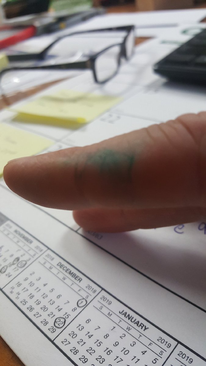 TurfPaintGirl's tweet photo. Hey @turftechno...I think you may have a little something for this issue right??? #turfcolorants #greenthumb https://t.co/uoQDgqpBck