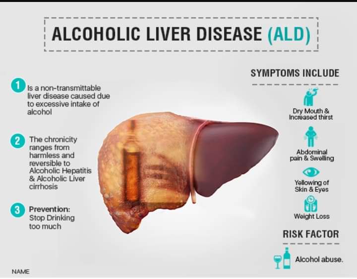 BunnyLawrence7's tweet photo. LIVER DISEASE!!!

Do you know that untreated liver disease may progress to liver failure failure! A life threatening condition! How often do you check your liver? https://t.co/sfsf2Zil13