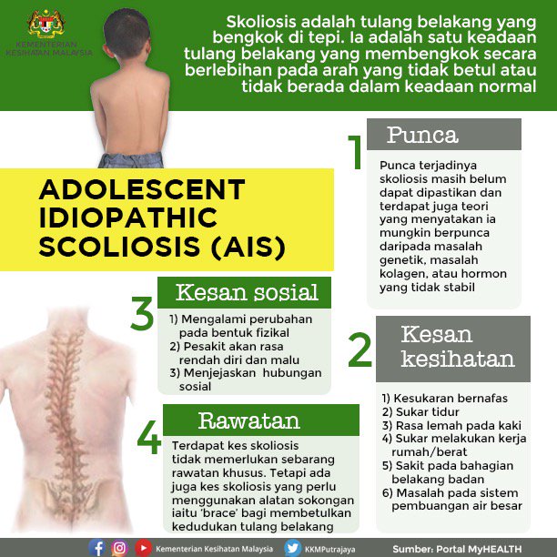 Maksud scoliosis What Is