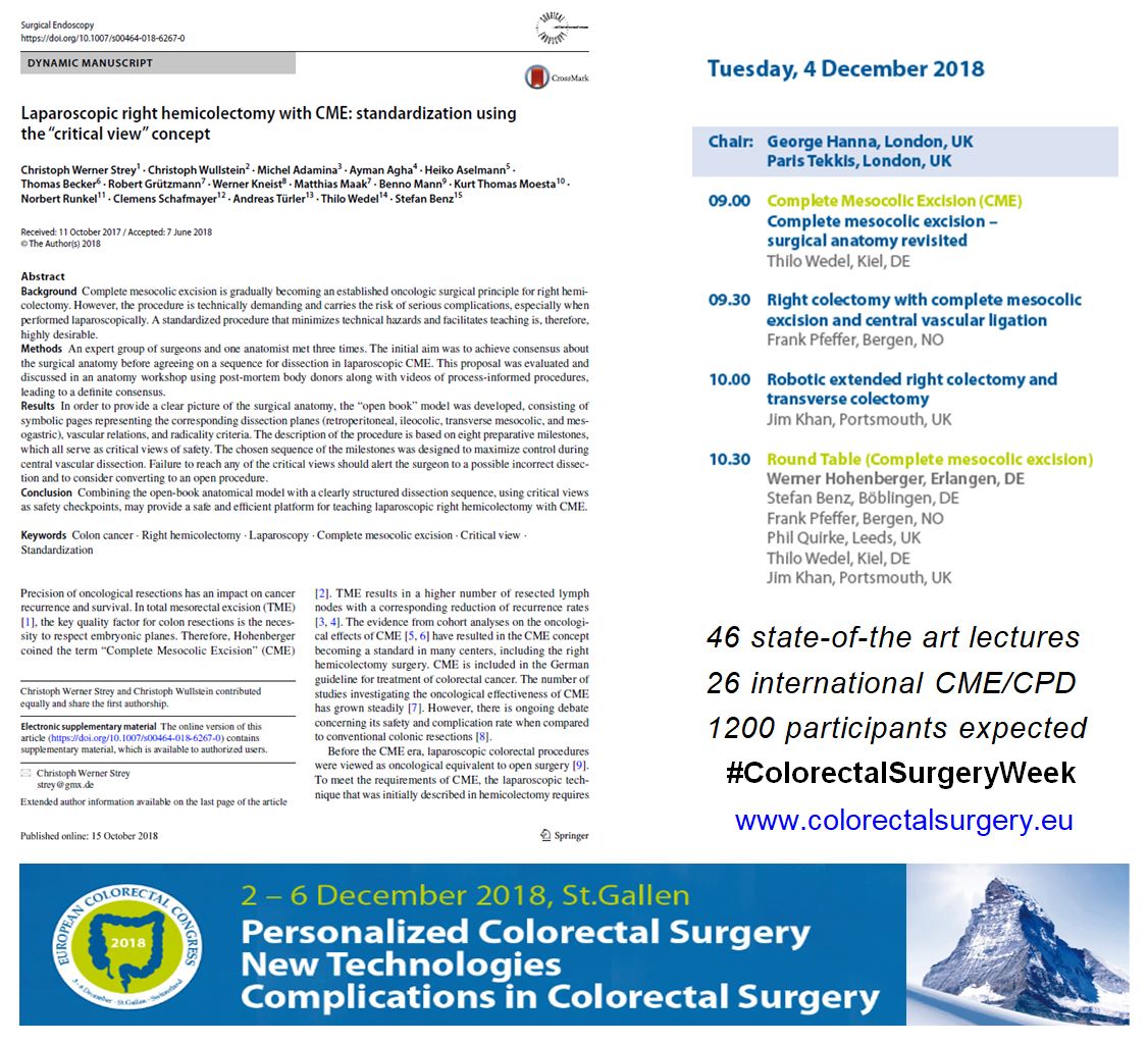 MichelAdamina's tweet photo. Serious complications of laparoscopic complete mesocolic excision threatens to negate superior #oncology outcomes. A standardised procedure was published by a consensus panel of 15 surgeons. Open #manuscript https://t.co/9iaVJoDqBg  https://t.co/0WPFaf4Pdy to discuss it further https://t.co/pkuZgFY6oI