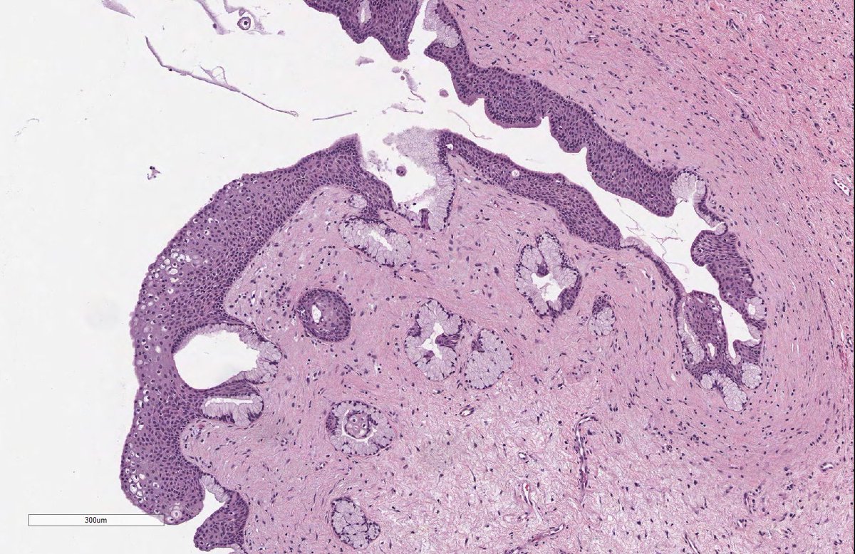 Bartholin Gland Histology