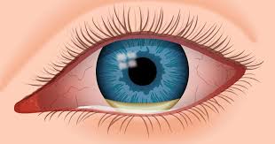 2019Eye's tweet photo. Find More Information About Ophthalmology@
In addition to being upside-down, images arrive at your retina split in half and distorted.
#OphthalmicVisionScience #VisionRehabilitation #OphthalmicCaseStudies #Acupuncture #Eye https://t.co/XfF4tYHKMK