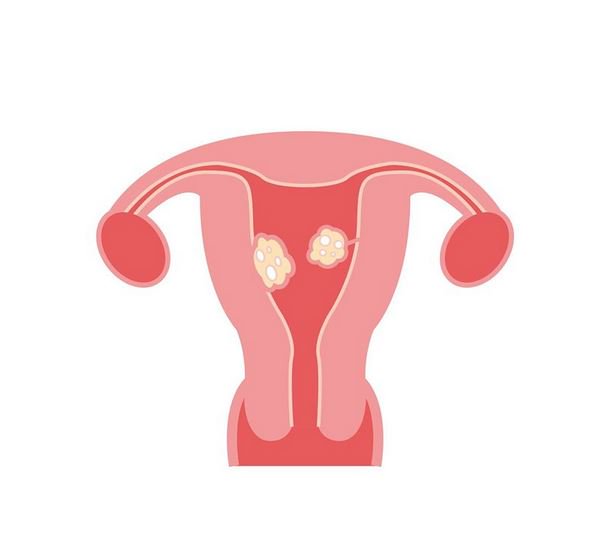 Forscher des Frankfurter Krankenhauses Nordwest erhalten Zuschlag für  richtungsweisende Studie des Gemeinsamen Bundesausschusses (G-BA) zur  Behandlung von gutartigen Gebärmuttertumoren. Weitere Informationen: krankenhaus-nordwest.de/pressemitteilu…