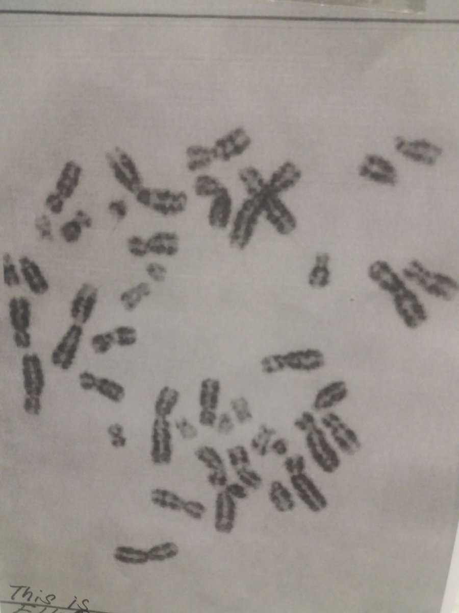 ScienceRad's tweet photo. My #Metaphase spread. Is this all what is making me? Don't think so! And think about it; Homo sapiens and mice DNA sequence just differs with 2.5% !!!!! #cannotbe https://t.co/wEBjGutE93