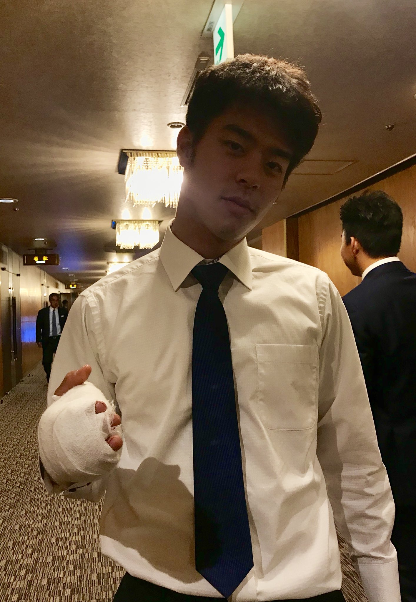 スポニチ ドラゴンズ愛 Al Twitter 血行障害の手術を受けた鈴木翔太投手は まだ痛い と顔を歪めてましたが抜糸後 12月中旬にはキャッチボールを再開できるそうです ドラ番記者 中日ドラゴンズ 鈴木翔太 50針以上縫合 右手臭い自慢 T Co Edsyytspn2 スポニチ ドラゴンズ愛 Al Twitter 血行障害の手術を受けた鈴木翔太投手は まだ痛い と顔を歪めてましたが抜糸後 12月中旬にはキャッチボールを再開できるそうです ドラ番記者 中日ドラゴンズ 鈴木翔太 50針以上縫合 右手臭い自慢 T Co Edsyytspn2