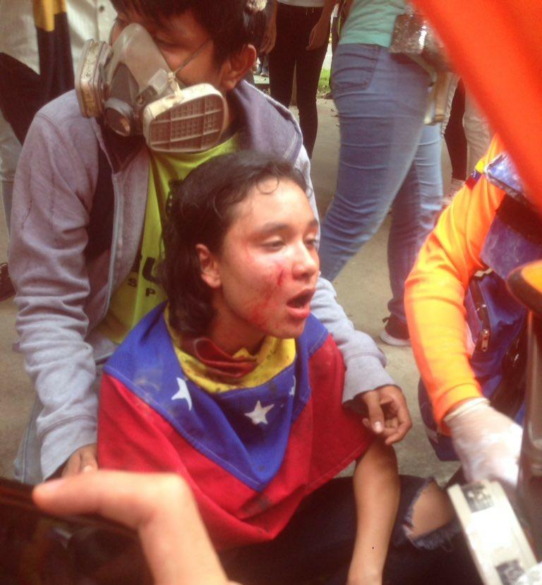 Esta es la imagen que vuelve a crear la #Dictadura el #DiaDelEstudianteUniversitario. Estudiantes heridos. Ucevistas heridos por la represión de la dictadura chavista. #AbajolaDictadura