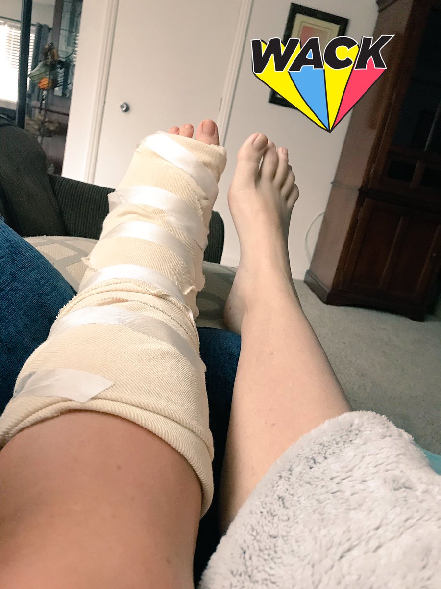 GreeleyHunter's tweet photo. Third times a charm right? #hellopain https://t.co/OMliCxFVLf