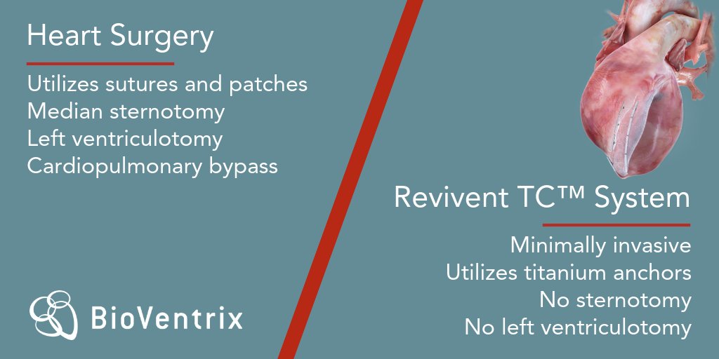BioVentrixDE's tweet photo. Erfahren Sie mehr über den Unterschied zwischen dem #ReviventTC System und reinen herzchirurgischen Eingriffen unter https://t.co/Zbf7oG6iCV https://t.co/uMGT0DaLvz
