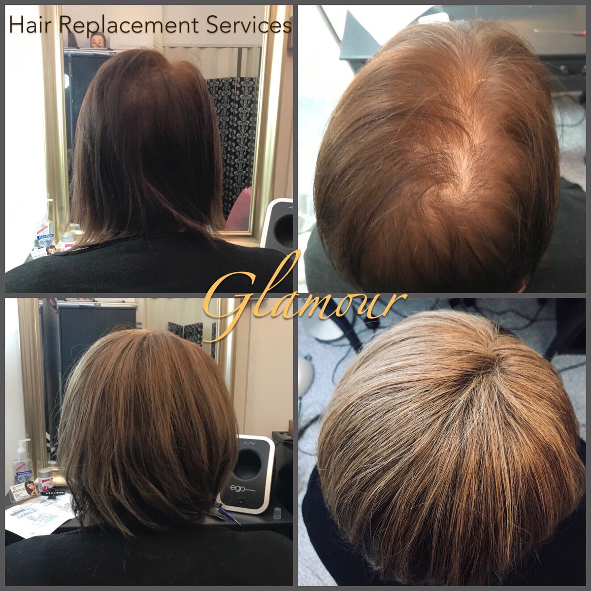 GlamourbyVicki's tweet photo. #changingpeopleslives #hairintegration #hairgoals #hairreplacement #glamour #cannock #hednesford #lovemyjob #hairextensions #remyhair #transformationwednesday #besthairextensions #alopecia #thinninghaursolution #staffordshire #westmidlands #hairsalon https://t.co/VyRTTjrQ5A